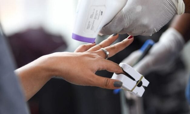 Severity of COVID-19 Pneumonia Pulse Oximeter Readings Unreliable for Ethnic Groups