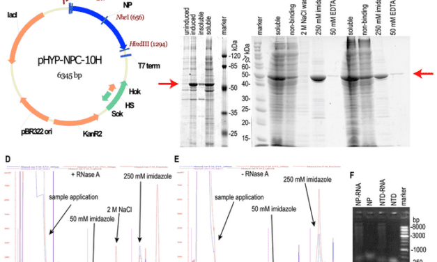 Pure Coronavirus Nucleoprotein Antibody Tests Are More Accurate, Sensitive