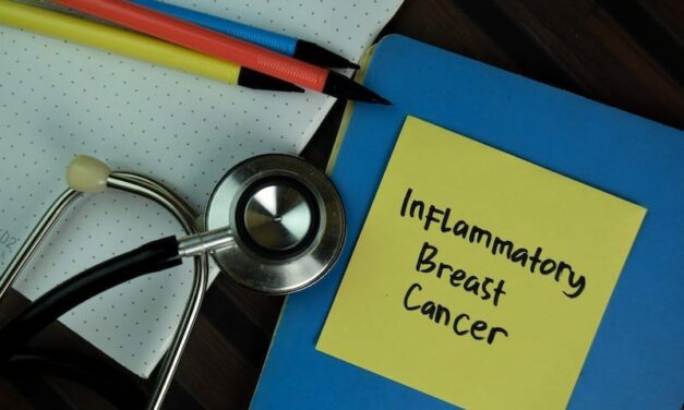 Novel Tool Helps Diagnose Inflammatory Breast Cancer