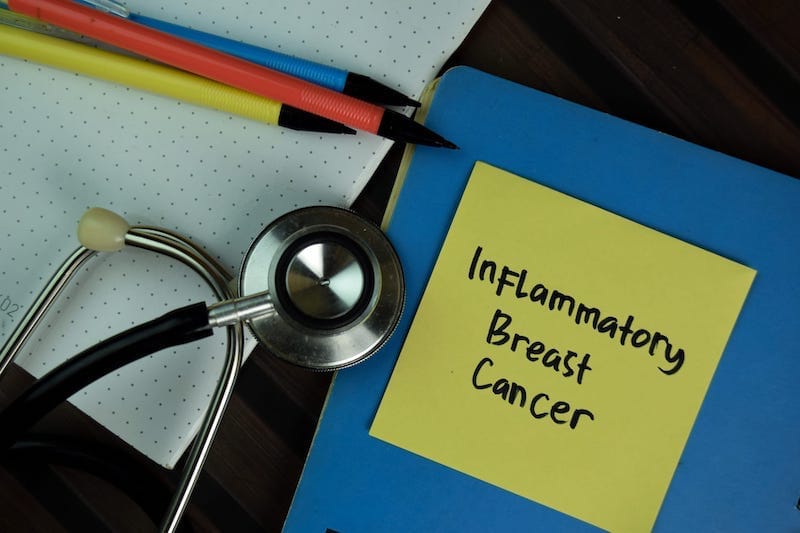 Novel Tool Helps Diagnose Inflammatory Breast Cancer