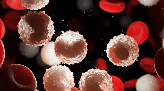 Acute Myeloid Leukemia Subtypes Help Treatment