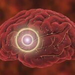 POC Test for Stroke, Concussion Developed from Male Fertility Research 