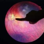 Diabetes Patients Who Skip Screenings May Miss Early Vision Loss Diagnosis