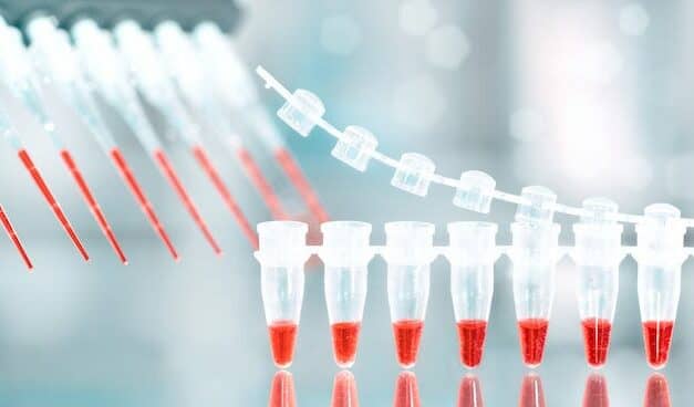 M. Genitalium Testing: Protecting Patient Reproductive and Sexual Health