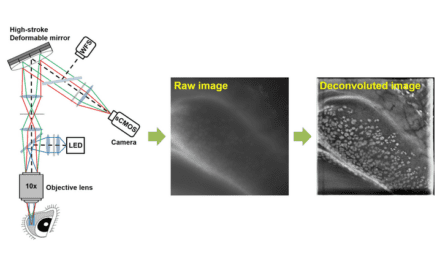 High Performance Microscopy Improves Non-Invasive Conjunctival Goblet Cell Examination