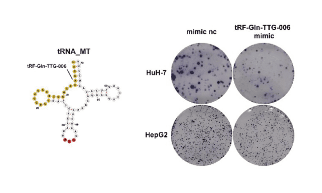 New tsRNA Found in Blood May Improve Liver Cancer Diagnosis