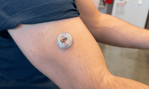 Wearable Device Monitors Glucose, Alcohol, and Lactate