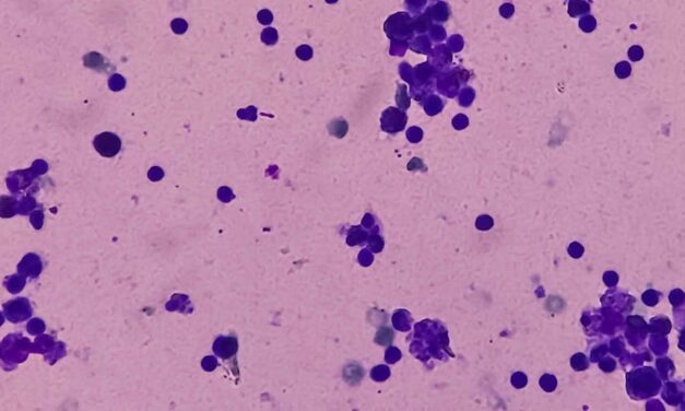 Researchers Find Tumor-Based Methylation Patterns as Cancer Biomarkers