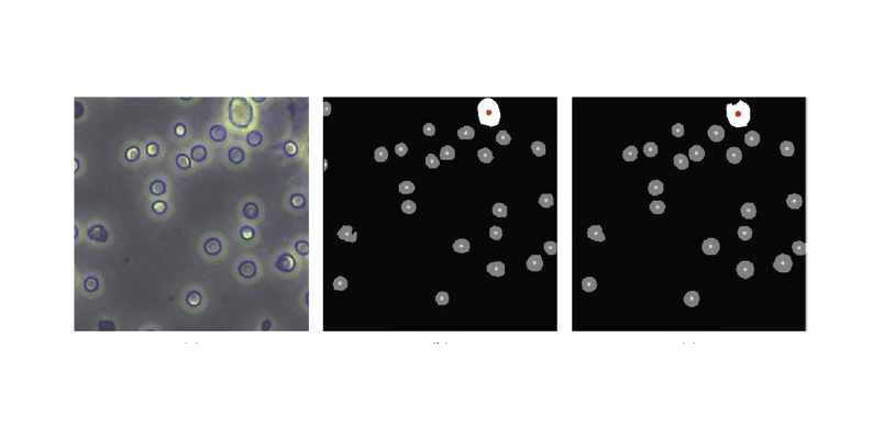 Machine Learning Reduces Cell Counting Workload for Disease Diagnosis