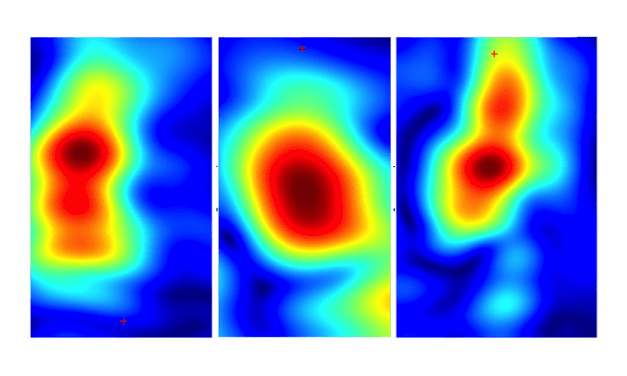 Handheld Device Could Painlessly Identify Skin Cancers