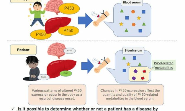 Biomarker Developed for Parkinson’s Disease Diagnosis