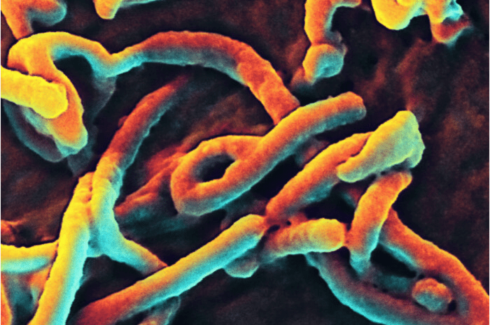 Rapid Ebola Diagnosis May Be Possible