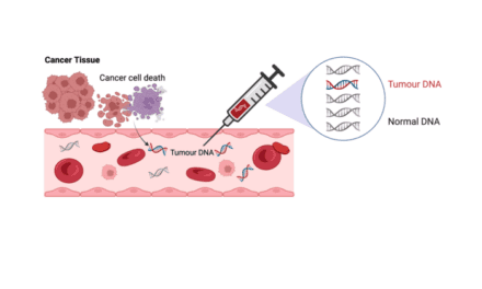 New Blood Test Could Spare Colon Cancer Patients from Unnecessary Chemotherapy