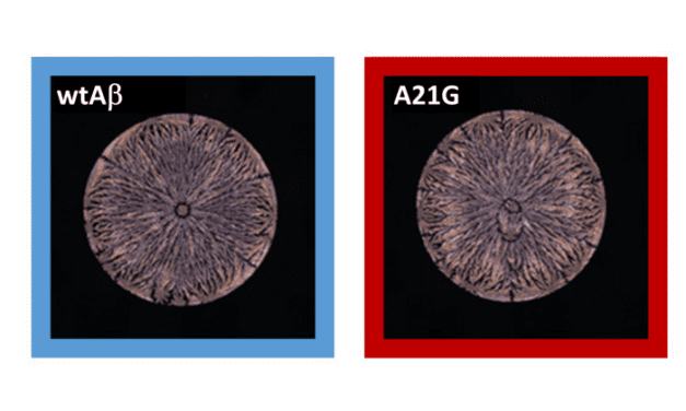 Peptide ‘Fingerprint’ Enables Earlier Alzheimer’s Diagnosis