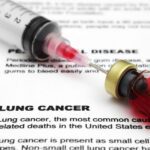 Blood Biomarker May Help Verify CT-Captured Lung Cancer