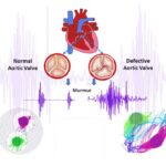 Low-Cost Disease Diagnosis by Mapping Heart Sounds