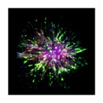 Scientists Identify Biomarkers in Cells that Spread a Deadly Form of Breast Cancer
