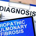 The Clinical Lab’s Role in Diagnosing Idiopathic Pulmonary Fibrosis