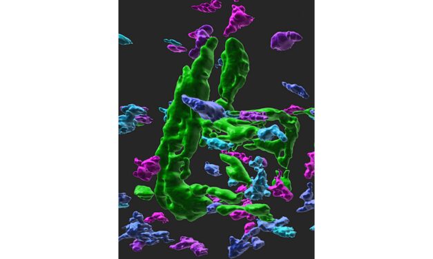 Blood Marker May Predict Risk of Osteoporotic Hip Fracture