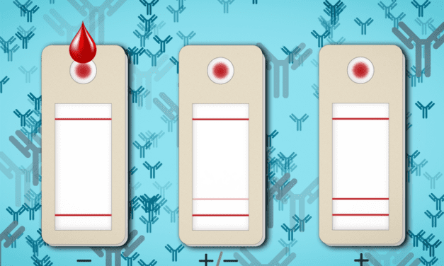 New Test May Predict COVID Immunity