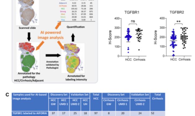 Immunohistochemistry Helps ID Risk for Hepatocellular Cancer