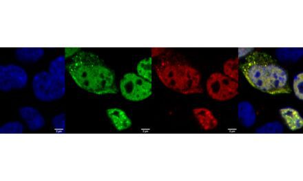 In-Silico-Designed Protein Probes May Diagnose Neurodegenerative Diseases Earlier