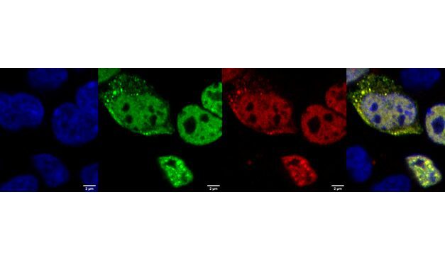 In-Silico-Designed Protein Probes May Diagnose Neurodegenerative Diseases Earlier