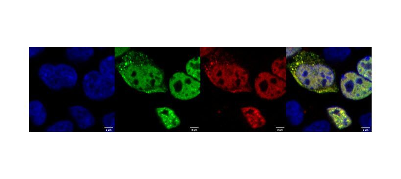 In-Silico-Designed Protein Probes May Diagnose Neurodegenerative Diseases Earlier