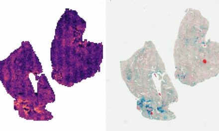 MobiDev Shares Research on WSI Processing for Cancer Detection