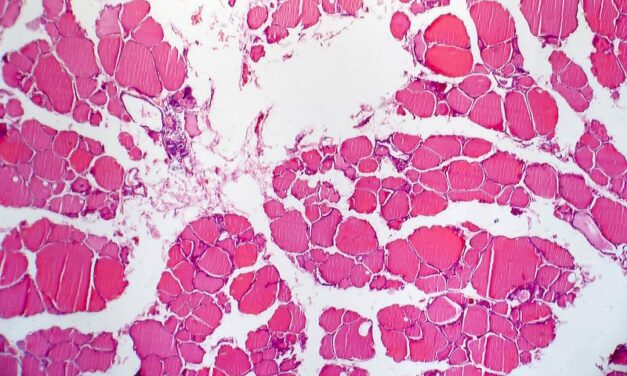 FDA Approves Thermo Fisher’s NGS-based CDx Test for RET-Positive Thyroid Cancer