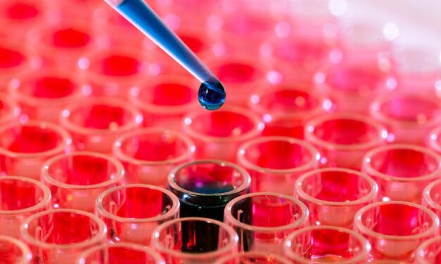 Blood Test Detects and Predicts COVID-19 Severity