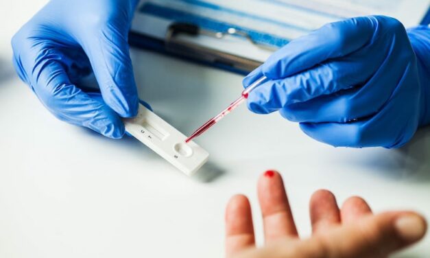 Roche Launches SARS-CoV-2 Rapid Antibody Test 2.0