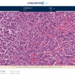 New Version of Concentriq Dx Enables 100% Digital Diagnosis