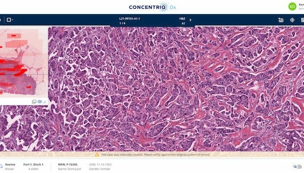 New Version of Concentriq Dx Enables 100% Digital Diagnosis