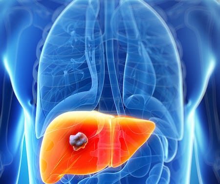 AI Liquid Biopsy Platform Shows Promise for Liver Cancer Detection