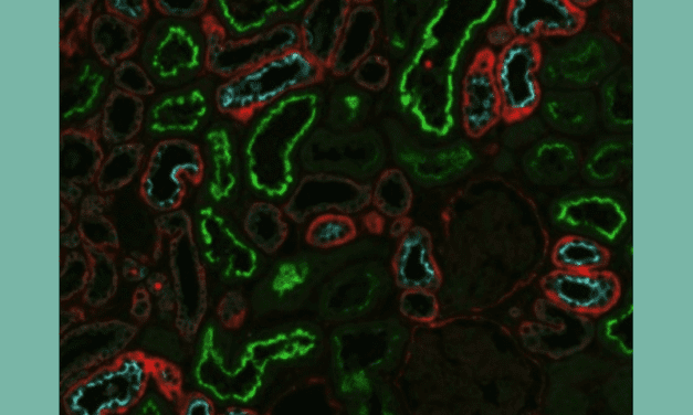 Researchers Identify Early Diagnosis Tool for Childhood Kidney Disease