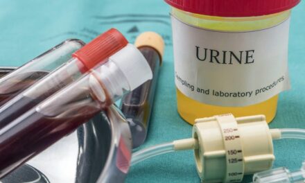 Diagnosing UTIs with Urine PCR