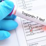 Cardiac Troponins Key to Improving Heart Attack Diagnostics
