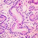 Diasorin’s Congenital Cytomegalovirus Detection Assay Gets FDA Clearance