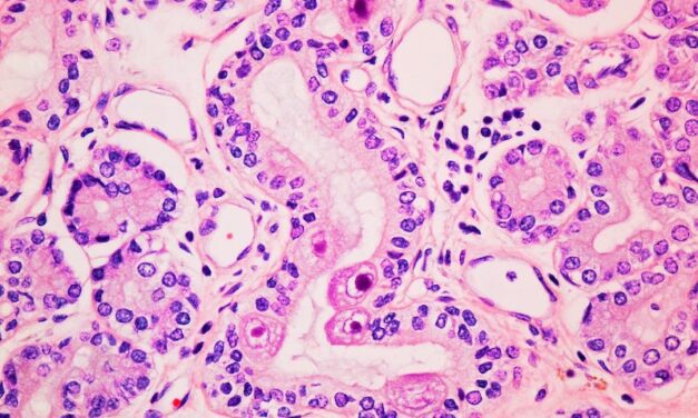 Diasorin’s Congenital Cytomegalovirus Detection Assay Gets FDA Clearance