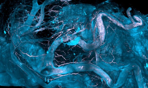 Novel Spatial-omics Technology Enables Early Investigation of Diseases