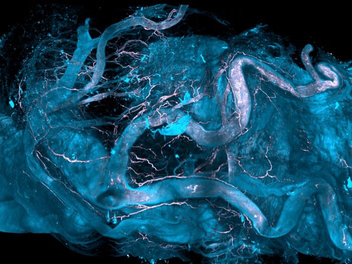 Novel Spatial-omics Technology Enables Early Investigation of Diseases