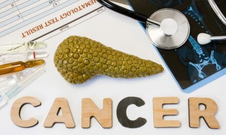 NCI Grant to Improve Early Detection of Pancreatic Cancer