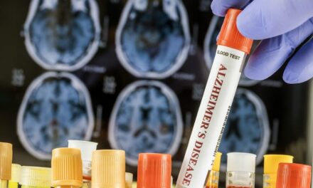 New Blood Test Validated for Early Alzheimer’s Detection