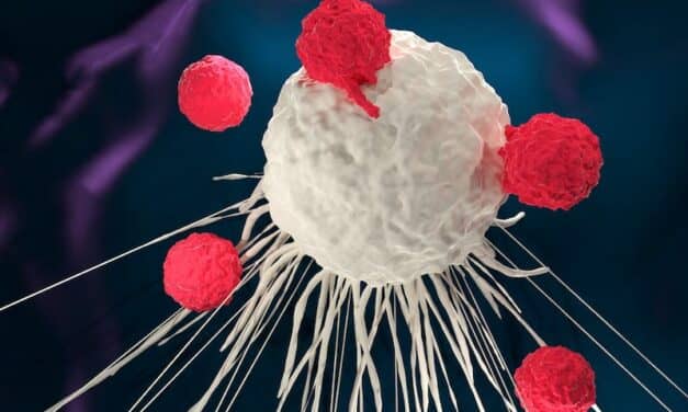 Eurofins Viracor Launches Test to Assess CAR-T Therapy in Cancer Patients