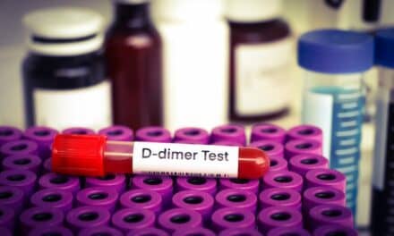 D-Dimer Blood Test Shows Value in Detecting Prosthetic Joint Infections