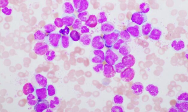 As CML Outcomes Improve, Demand Rises for BCR::ABL1 Testing