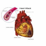 How RNA Biomarkers Could Help Diagnose Heart Disease