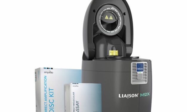 DiaSorin Simplexa COVID & Flu A/B Assay Gets FDA Clearance