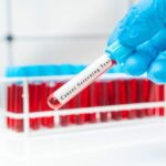 How Single-Cancer Testing Could Revolutionize Diagnostics